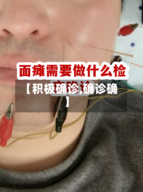 【积极确诊,确诊确】