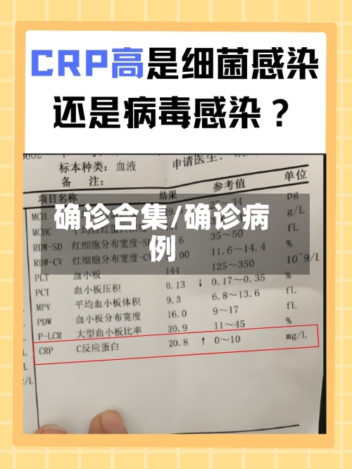 确诊合集/确诊病例