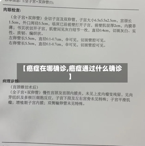 【癌症在哪确诊,癌症通过什么确诊】-第2张图片