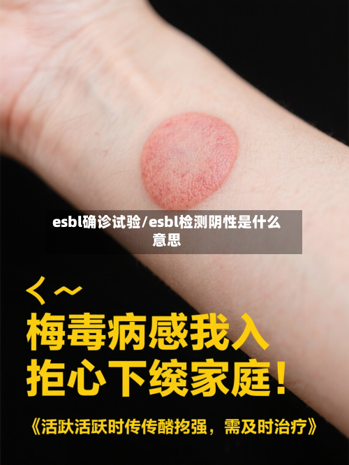 esbl确诊试验/esbl检测阴性是什么意思