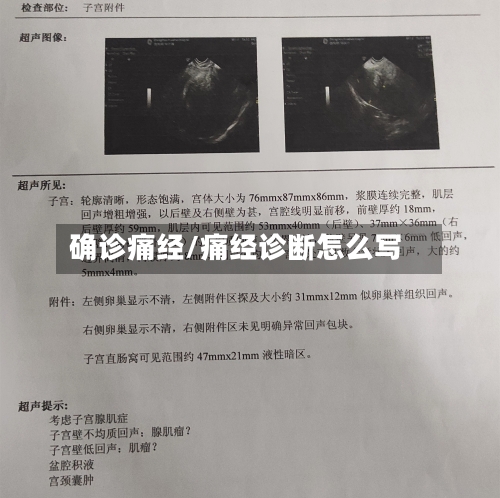 确诊痛经/痛经诊断怎么写