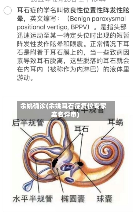 余姚确诊(余姚耳石症复位专家实名评审)
