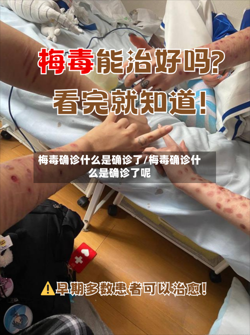 梅毒确诊什么是确诊了/梅毒确诊什么是确诊了呢