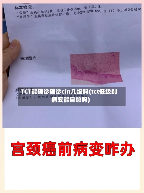 TCT能确诊确诊cin几级吗(tct低级别病变能自愈吗)-第2张图片