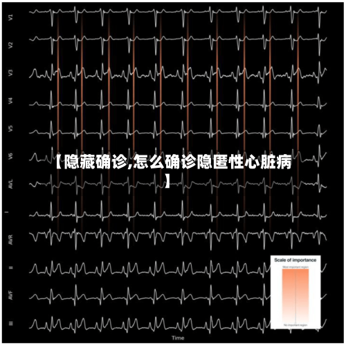 【隐藏确诊,怎么确诊隐匿性心脏病】