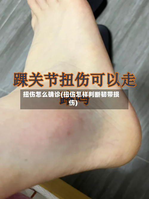 扭伤怎么确诊(扭伤怎样判断韧带损伤)-第2张图片