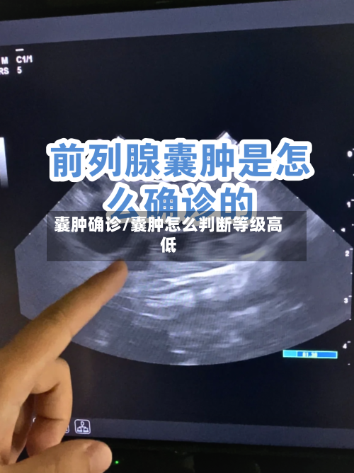 囊肿确诊/囊肿怎么判断等级高低-第2张图片