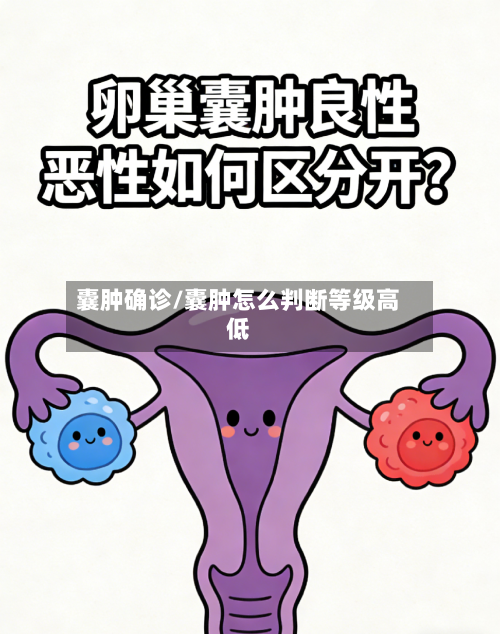 囊肿确诊/囊肿怎么判断等级高低-第3张图片