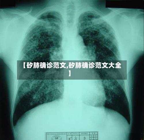 【矽肺确诊范文,矽肺确诊范文大全】-第2张图片