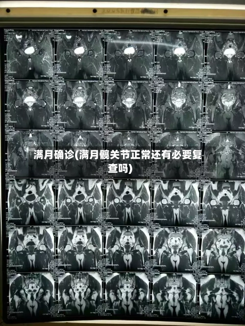 满月确诊(满月髋关节正常还有必要复查吗)