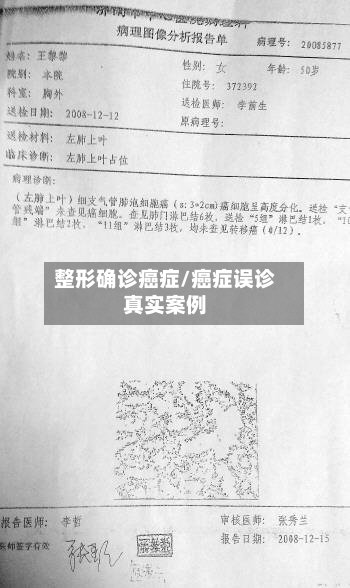 整形确诊癌症/癌症误诊真实案例-第2张图片