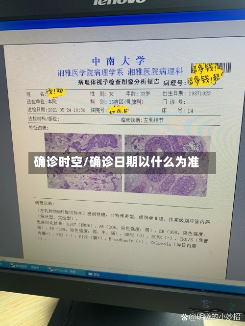 确诊时空/确诊日期以什么为准-第3张图片