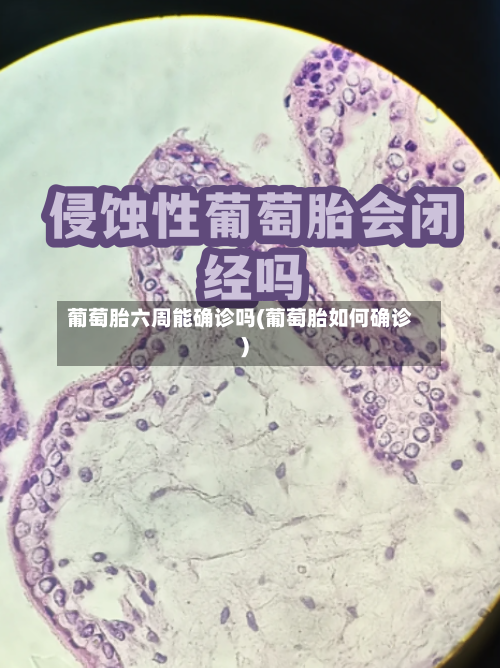 葡萄胎六周能确诊吗(葡萄胎如何确诊)-第2张图片